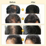 Purc Ginger Shampoo Set Anti Hair Loss Fast
