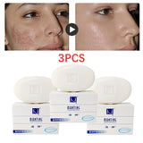 Manting Mites Acarus Acari Removing Body Face