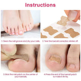 Ingrown Toenail Corrector Patches Nail Correction Care