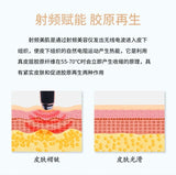 Radio Frequency Eye Beauty Instrument Eye Introduction Massage