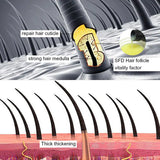 Sevich Anti Hair Loss Product Hair Loss Shampoo