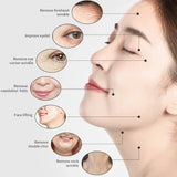 Skin Care Multi-Functional Rf Facial Equipment Frequency Skin