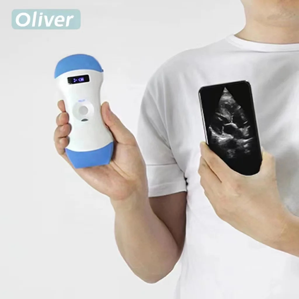 Wireless Ultrasound Probe Scanner Portable Bluetooth Machine Wifi